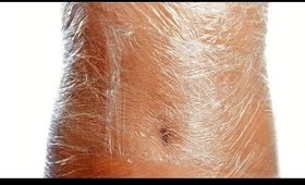 How to Remove Stretch Marks Using Vicks Vaporub  | SuperWowStyle Prachi