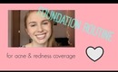 Foundation Routine for Acne & Redness Coverage