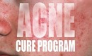 THE ACNE CURE PROGRAM! FAST RESULTS!