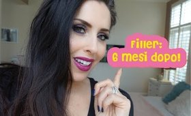 FILLER: LO RIFAREI?!