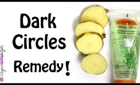 How to Get Rid of Dark Circles Naturally? _ DIY Home Remedy _ SuperWowStyle