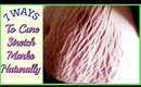 7- Home Remedies To Cure Stretch Marks Naturally Fast | SuperPrincessjo