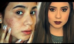 GET READY WITH ME THANKSGIVING - ACNE SCARS COVERAGE DRUGSTORE MAKEUP  -   FULL COVERAGE FOUNDATION