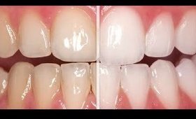 EASIEST, MOST AFFORDABLE TOOTH WHITENING! NEW VIDEO!!