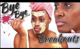 Say BYE BYE 👋🏾 to Breakouts Quickly | Shlinda1