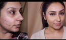 Drugstore full coverage acne scaring rosacea foundation routine olive brown skin || Makeup With Raji