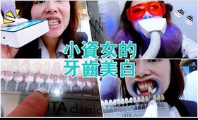 一千多塊的牙齒美白有用嗎？(三萬感謝小禮第二波請看FB)｜NT$1000ish Teeth Whitening Spa Review｜Nabibuzz娜比