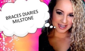 BRACES DIARIES MILESTONE