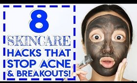 8 Skincare Hacks That Stop Acne & Pimples!