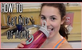 How to Get Rid of Acne