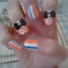 Polkadot/Stripe Nails With 3D Bow