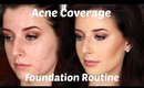 Full Covergae Foundation Routine For Oily Acne Scarred Skin + Contour Routine
