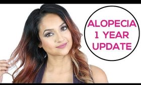 Alopecia 1 Year Update | Alopecia Awareness