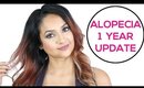 Alopecia 1 Year Update | Alopecia Awareness