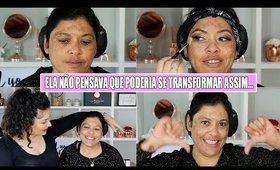 ELA TINHA A PELE MANCHADA E NÃO SE ACHAVA BONITA | #DudaTransforma #2