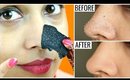 BLACKHEADS & WHITEHEADS Peel Off Mask - Instant Results | Shruti Arjun Anand