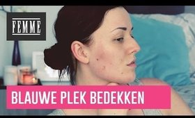 Blauwe plekken bedekken - FEMME