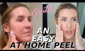 At Home Glycolic Acid Peel THAT WORKS! | Over 40 Skincare