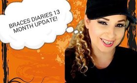 Braces Diaries 13 Month Update