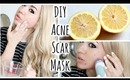 DIY Acne Scar Fading Mask + Quick Acne Tips!
