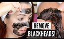 BLACKHEAD REMOVAL MASK! Peel Off Mask From JAPAN!