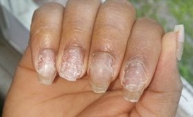 How I fix my nails with tips and acrylic (speed tutorial)