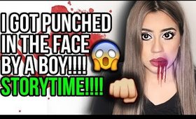 I GOT PUNCHED BY A BOY IN THE FACE - STORY TIME