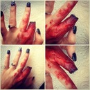 SFX chopped finger