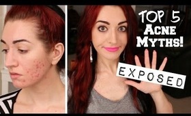 TOP 5 ACNE MYTHS EXPOSED! The Truth About Acne!