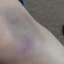 Bruise 