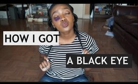 Storytime | How I Got A Black Eye Before Prom