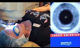 I GOT LASIK DONE! LasikPlus for Astigmatism- Does it Work/Worth it??