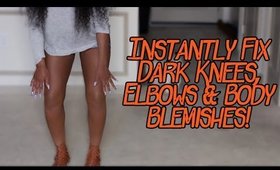 Instantly Fix Dark Elbows, Knees, & Body Blemishes! | Makeupd0ll