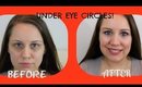 How I Conceal My Dark Under Eye Circles