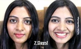 GIVEAWAY Open! -  7 Day Skin Care Challenge with Herbalife  (by superwowstyle)