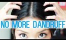 HOW TO: Get Rid Of Dandruff