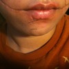 JOKER SCARS