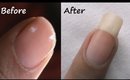 How to Grow Nails Faster Naturally?