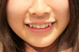 Japan’s Latest Beauty Trend: Paying Money To “Ruin” Your Teeth