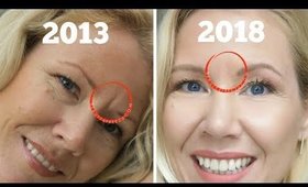 How to get rid of frown lines between eyes | BEAUTY OVER 40