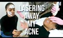 Treating My Acne With LaserAway + Skincare Chat | VLOG