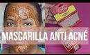 Mascarilla para controlar el acné  - Kathy Gámez