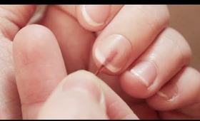 Splinter in my nail...