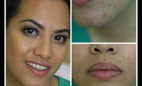 Foundation Routine for Acne Prone Skin