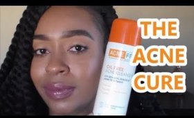 THE CURE TO ACNE!!!!!  | ACNEFREE 3 STEP SYSTEM