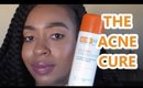 THE CURE TO ACNE!!!!!  | ACNEFREE 3 STEP SYSTEM