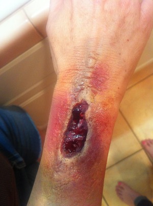 A special effects open wound look, very simple to achieve!