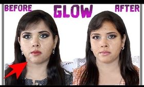 Pixi Glow Collection BEFORE & AFTER RESULTS ON ACNE
