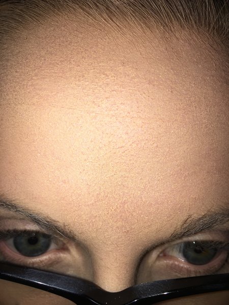 help-with-patchy-forehead-beautylish