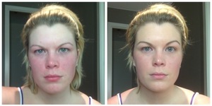  before and after shot of the Maybelline Dream Fresh BB Cream in Universal Glow